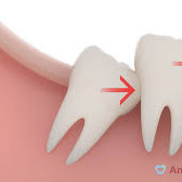 Cirurgia dentoalveolar, cirurgia oral ou bucal 