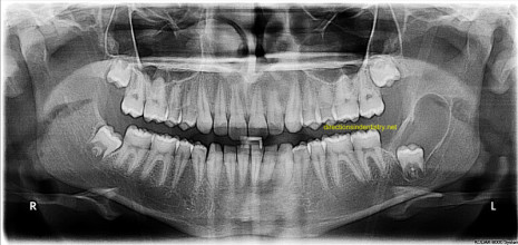 Cirurgia das patologias orais e maxilofaciais 