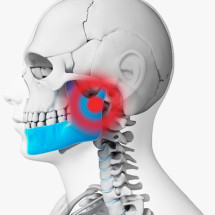 Tratamento das Disfunções da Articulação Temporomandibular (DTM)