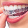 Thumb Alinhadores transparentes removíveis (Invisalign e Click Aligner) 