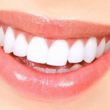 Limpeza dentária ( Profilaxia Dental )