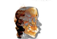 Assessment of the mechanical properties of glass ionomer cements for orthodontic cementation